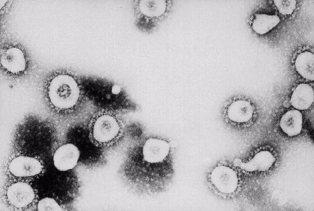 Coronavirus