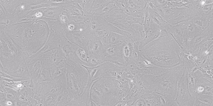 Células epiteliales del timo derivadas de células iPS, visualizadas por microscopía de contraste de fase.