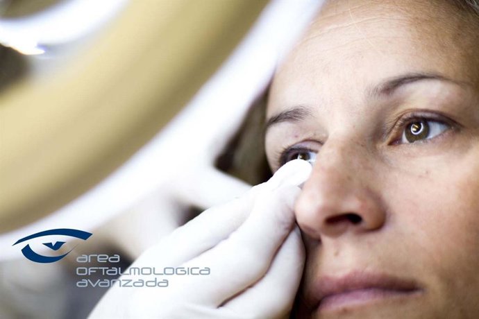 Tratamiento de ojo seco en Área Oftalmológica Avanzada