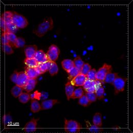 Esta imagen muestra a las células T interactuando entre sí. Las superficies de las células están marcadas en rojo, los núcleos de las células en azul y los receptores que median en la comunicación en verde.
