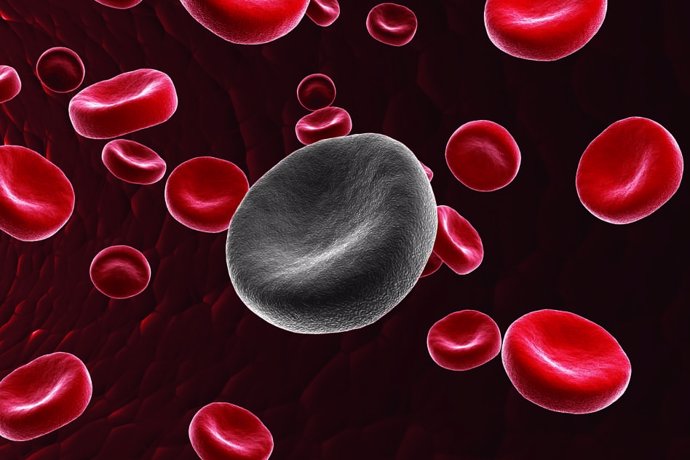 Las células CART se relacionan con la mejora en pacientes de leucemia linfocítica crónica.