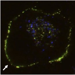 Complejo de proteína clusterina-aberrante marcado con fluorescencia.