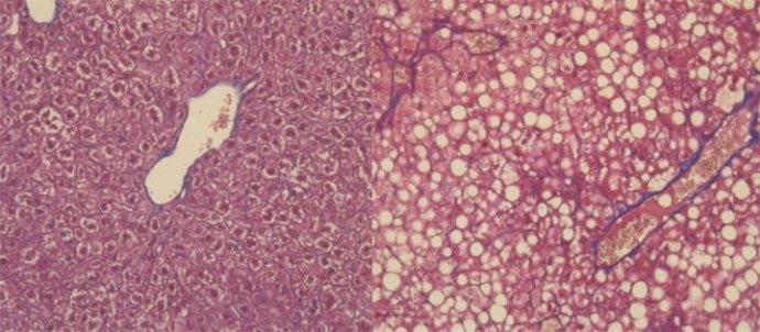 Células hepáticas bajo microscopía