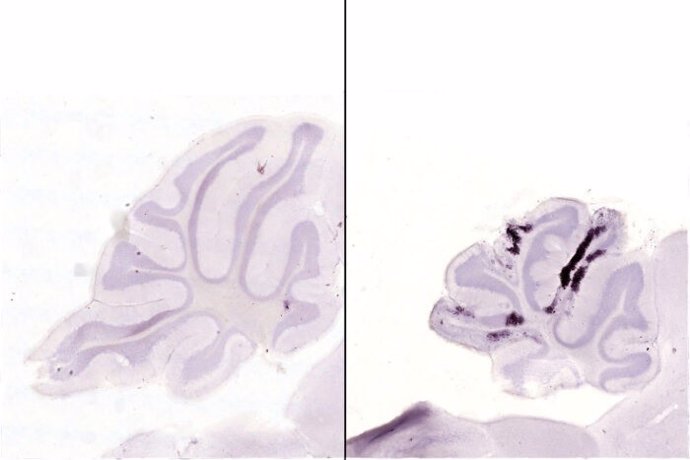 Las manchas púrpuras oscuras indican neuronas moribundas. El cerebro de un ratón infectado con una cepa del virus Zika de Brasil (derecha) está encogido y tiene más células moribundas, frente al de la Polinesia Francesa (izquierda)