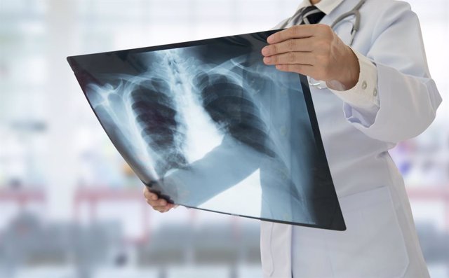 Médico mirando una radiografía de los pulmones de un paciente.