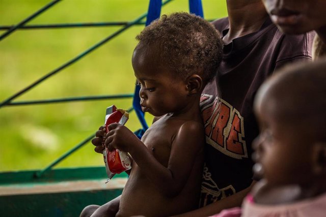 Un niño desnutrido en República Democrática del Congo