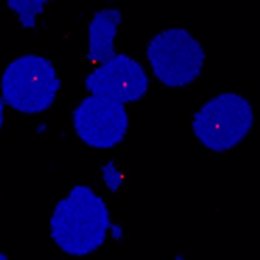 Los puntos rojos representan el complejo HIF-2 en las células de cáncer de riñón (círculos azules), formado cuando las proteínas HIF-2a y HIF-1 se unen.