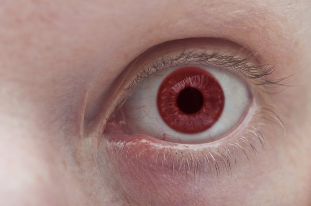 ¿por Qué En Las Fotos Se Ven Ojos Rojos Todo Sobre El Color De Los Ojos 