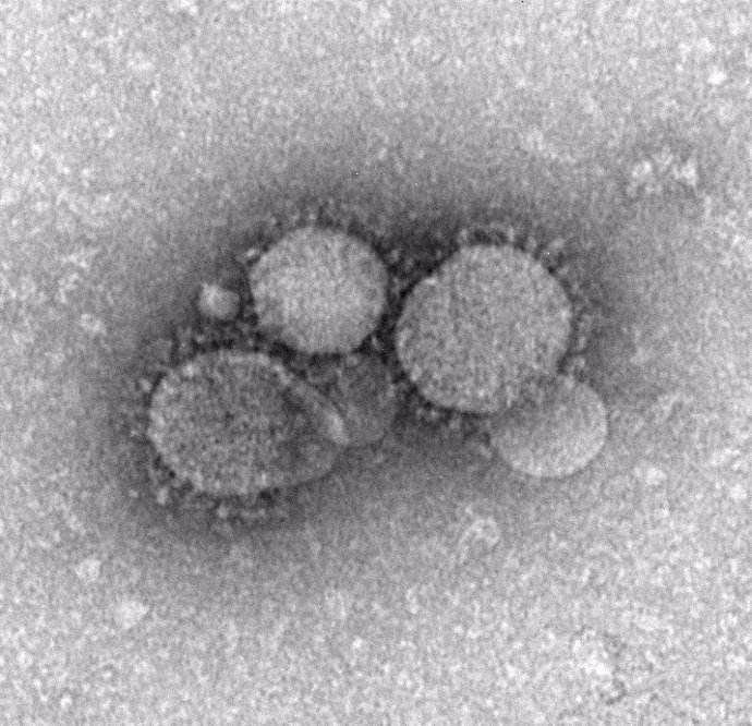 2012 - Atlanta, Georgia, United States: This negative stained transmission electron microscopic (TEM) image revealed ultrastructural morphology exhibited by the Middle East respiratory syndrome coronavirus (MERS-CoV), which was identified in 2012, as th