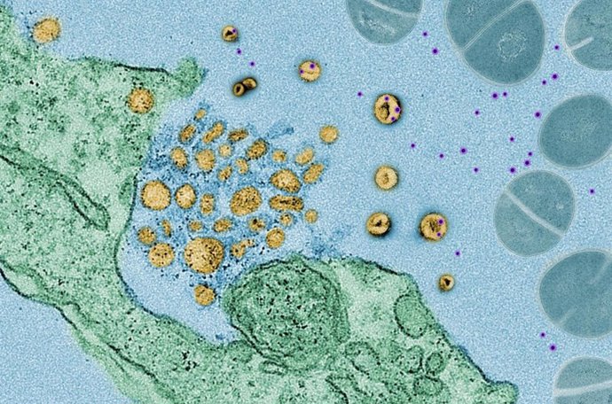 Imágenes de microscopía electrónica muestran 'exosomas' (en amarillo) absorbiendo toxinas (en púrpura) liberadas por bacterias (en azul), que están tratando de matar una célula pulmonar humana (en verde).
