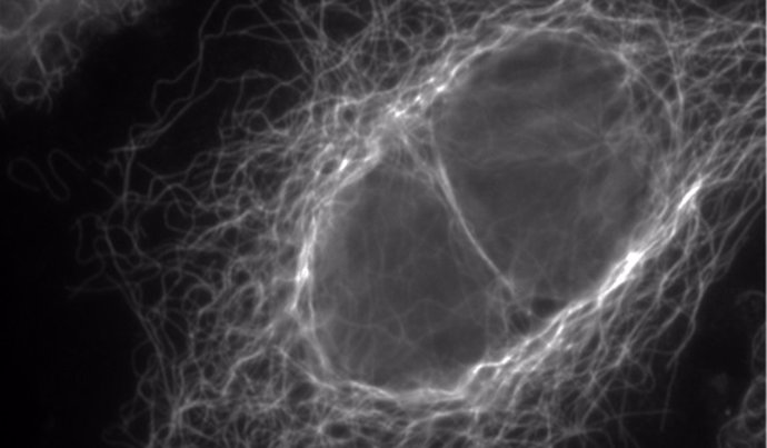 Los microtúbulos son el esqueleto de las células, les dan forma y regulan la división