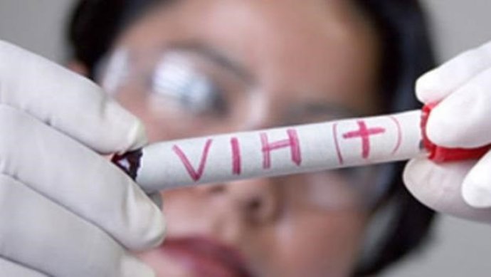 Virus del sida 