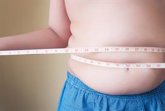 Foto: Obesidad infantil, así afecta a la salud