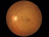 Foto: Investigan un circuito que podría ser clave en patologías oculares