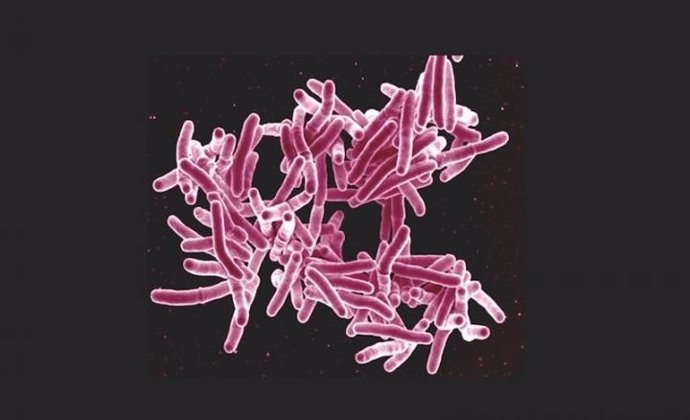 Mycobacterium tuberculosis, la bacteria causante de la tuberculosis