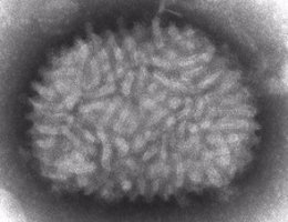 Imagen al microscopio del virus Vaccinia