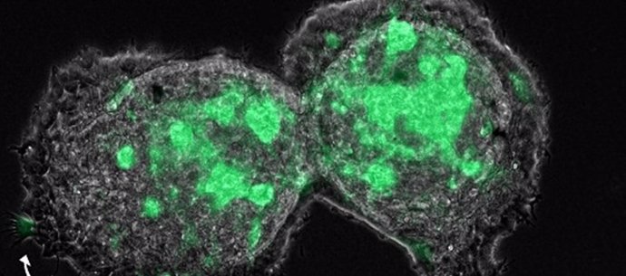 Los fibroblastos asociados con el cáncer (CAF) actúan como líderes de la invasión colectiva de las células tumorales en modelos de cultivo 3D.