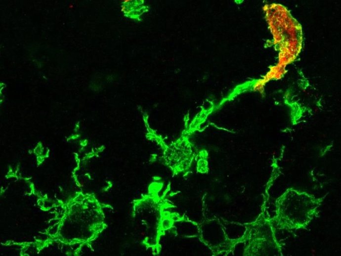 Macrófagos que emigran desde la médula osea (rojo) y la microglia residente en el cerebro (verde)