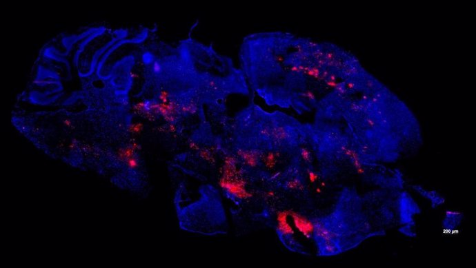 Imagen de cerebro de ratón infectado con un virus transmitido por mosquitos, el virus Semliki Forest, sin tratamiento con crema para la piel. El color rosado muestra el grado de infección con el virus.