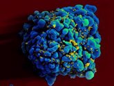 Foto: Un estudio abre la puerta a tratar con inmunoterapia el cáncer en personas con VIH