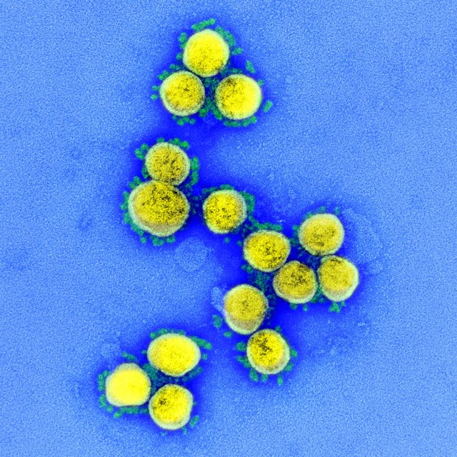 Micrografía electrónica de transmisión de partículas del virus SARS-CoV-2, aislada de un paciente, del Instituto estadounidense de Alergia y Enfermedades Infecciosas (NIAID).