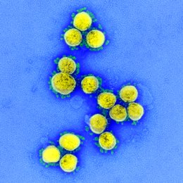 Coronavirus.- Francia suma más de 17.000 muertes por Covid-19 pero el número de 