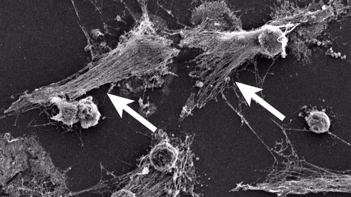 Parte del sistema inmunológico del cuerpo, los neutrófilos detectan las bacterias y pueden expulsar su ADN (ver flechas) para atacar a las bacterias con una red de gasa de ADN mezclada con enzimas tóxicas, llamada NET.