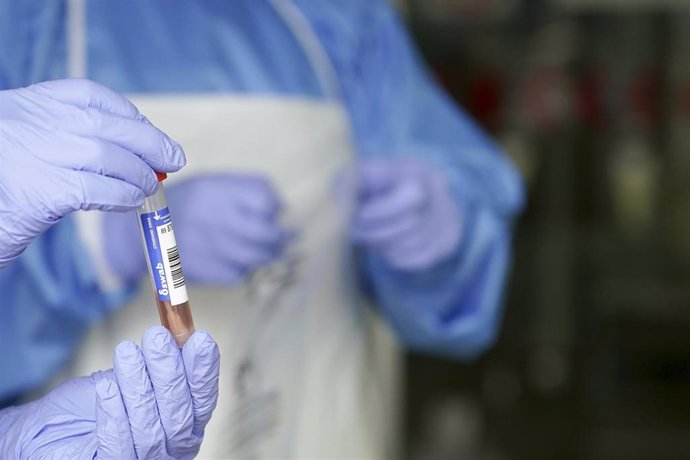 Un sanitario protegido con guantes sostiene un muestra para realizar un Análisis PCR, foto de archivo