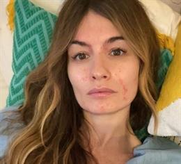 Madame de Rosa sigue con fuertes efectos por el COVID-19 y el estado anímico bajo