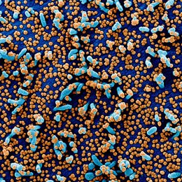 Micrografía electrónica de barrido coloreada de una célula VERO E6, en azul, infectada con partículas del virus SARS-COV-2, en color naranja, aislada de una muestra de paciente, capturada y mejorada por el NIAID, en Hamilton, Montana (Estados Unidos)