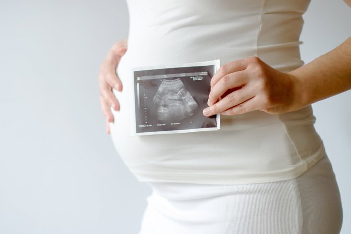 Pregnant Woman Holding Ultrasound Scan Photo