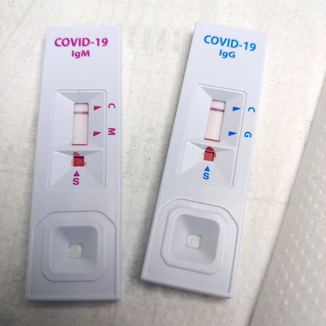 April 23, 2020 - Chevy Chase, Maryland USA: The latest COVID-19 test involves a small drop of blood which is then placed on strip tests. Fifteen (15) minutes later, the results show either positive or negative to the Covid-19 virus. (Patsy Lynch/Contacto)