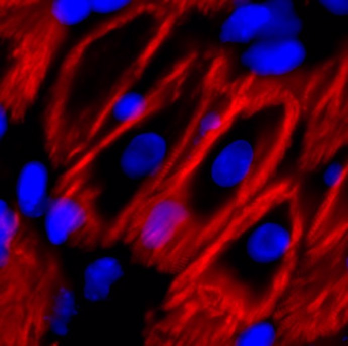En esta imagen de corazones de ratones adultos en la que los genes Hoxb13 y Meis1 fueron eliminados para el estudio, los cardiomiocitos muestran características que normalmente sólo se ven en los corazones de ratones recién nacidos.