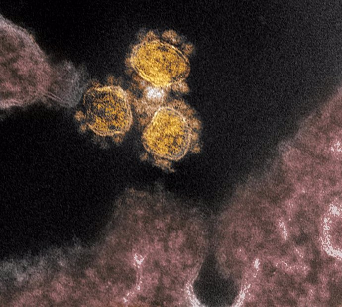 Imagen de microscopio electrónico del Instituto estadounidense de Alergia y Enfermedades Infecciosas (NIAID) del COVID-19.