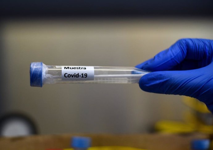 Coronavirus.- Chile informa de un récord diario de contagios y suma ya 247 muert