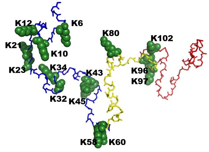 Investigación de la UIB sobre la relación entre la diabetes y el Parkinson