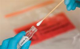 El test pel coronavirus InstaCOVID19 permetr la detecció d'una manera ultrarrápida i ultrasensible.