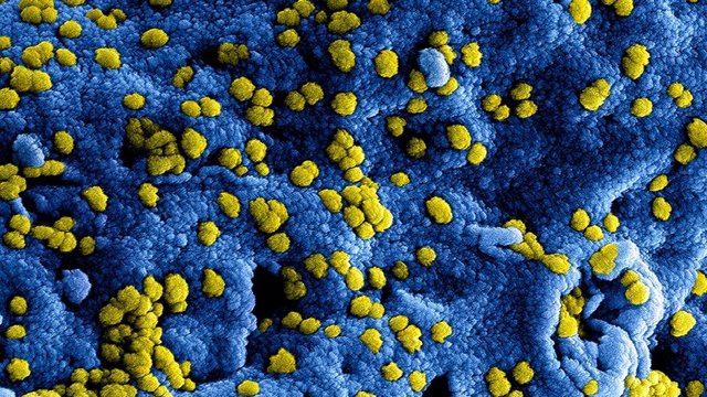 Imagen microscópica electrónica de escaneo digitalmente coloreada (SEM) de las partículas del coronavirus MERS.