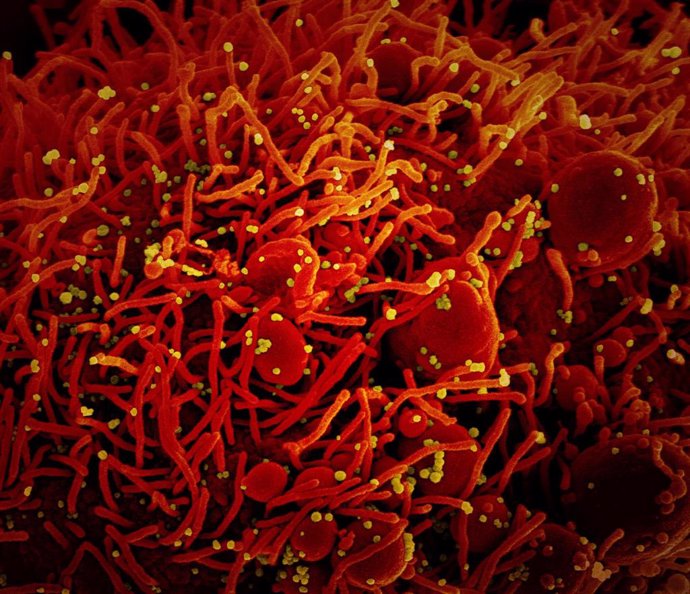 Micrografía electrónica de barrido coloreada de una célula apoptótica, en rojo, infectada con partículas del virus SARS-COV-2, en color amarillo, aislada de una muestra de paciente. 