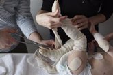 Foto: La EMA designa fármaco huérfano a un producto de terapia avanzada desarrollado en España para la piel de mariposa