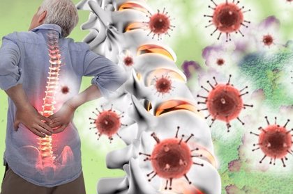 Dictado más lejos recuperar El dolor crónico de espalda afecta al sistema inmunológico": McGill  University de Montreal