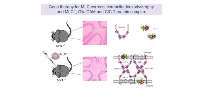Ofrecen una primera aproximación de terapia génica para la enfermedad MLC en modelos preclínicos