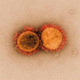 Micrografía electrónica de transmisión de partículas del virus SARS-CoV-2, aislada de un paciente y con realce del color, del Instituto estadounidense de Alergia y Enfermedades Infecciosas (NIAID), en Hamilton / Montana (Estados Unidos)