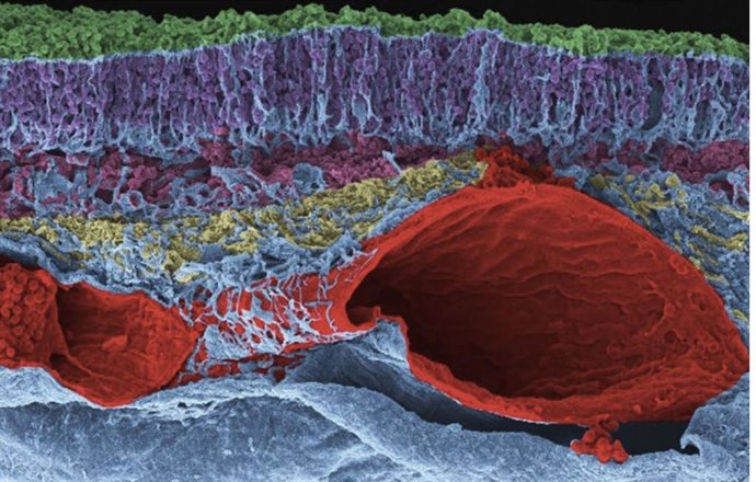 Fotografía de la exposición sobre el ojo de ballena analizado por la UPV/EHU, premiada en el certamen NeuroART 2020