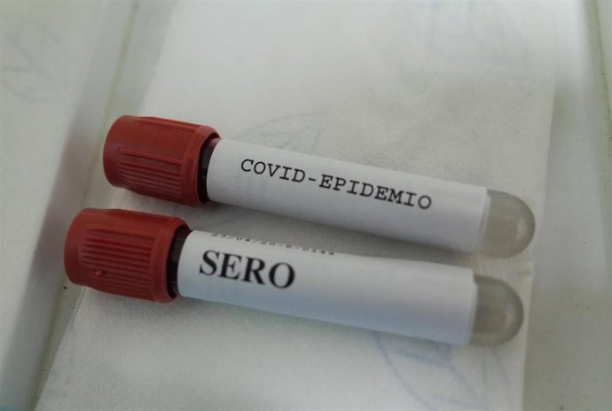 Muestras para la realización de un análisis de Covid-19