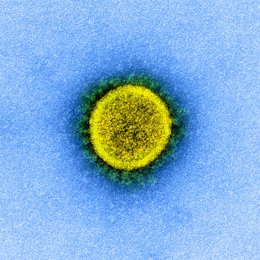 Micrografía electrónica de transmisión de partículas del virus SARS-CoV-2, aislada de un paciente, del Instituto estadounidense de Alergia y Enfermedades Infecciosas (NIAID).