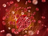 Foto: Las anomalías en coagulación de la sangre revelan qué pacientes corren riesgo de trombosis