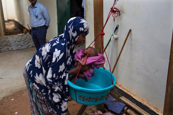 Un niño con desnutrición en Somalia