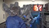 Foto: El Hospital de Valdecilla realiza la tercera cirugía mundial que combina la robótica y la radioterapia intraoperatoria