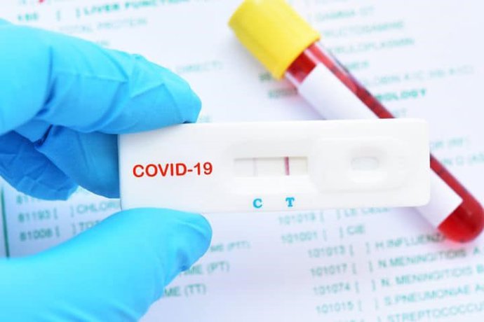 Prueba de detección del Covid-19